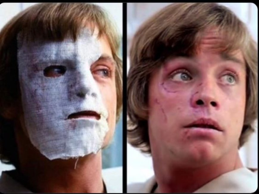 *Mark Hamill overleeft zwaar auto-ongeluk voor ‘The Empire Strikes Back’**