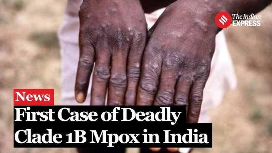 India bevestigt eerste geval van mpox